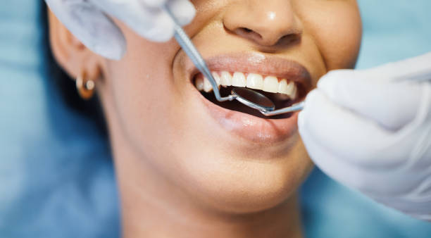 Best Emergency Tooth Extraction in East Rutherford, NJ
